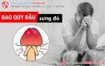 Thông tin về tình trạng bao quy đầu sưng đỏ