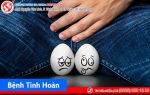 Bệnh tinh hoàn – Nỗi sợ của đàn ông