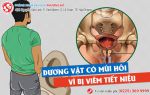 Bật mí: Tại sao dương vật có mùi hôi