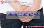 Nguyên nhân sưng dương vật và cách điều trị