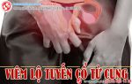 Viêm lộ tuyến cổ tử cung và cái nhìn đúng đắn