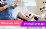Khám phá bí mật về huyết trắng vón cục