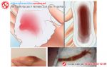 Chị em khốn khổ khi ra nhiều khí hư có màu nâu