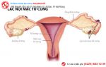Quan hệ thốn bụng dưới – chẳng “phê” mà chỉ thấy đau