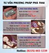 Đông đảo phái đẹp tìm đến phá thai ở Thái Bình