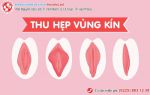 Phương pháp thu hẹp vùng kín không đau, chị em đã biết chưa?