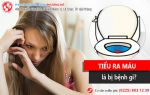 Tiểu ra máu ở nữ, đến viện kiểm tra mới tá hỏa nhiều bệnh nguy hiểm