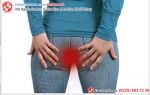 Bệnh trĩ từ A đến Z: Tất tần tật thông tin mà bạn cần biết