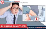 Cẩn thận với tình trạng đi ngoài ra máu tươi