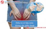 Cách điều trị rò hậu môn hiệu quả, không cần phẫu thuật