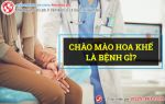 [Thắc mắc] Bệnh chào mào hoa khế là bệnh gì?