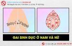 Hình ảnh gai sinh dục ở nam và nữ dễ nhận biết nhất