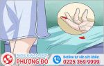 Chảy Máu Âm Đạo - Dấu Hiệu Bệnh Phụ Khoa Nguy Hiểm