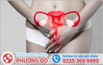 Đừng Chủ Quan Với Những Dấu Hiệu Cảnh Báo Bệnh Phụ Khoa