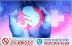 Phương Pháp Phá Thai Theo Tuần An Toàn Và Hiệu Quả