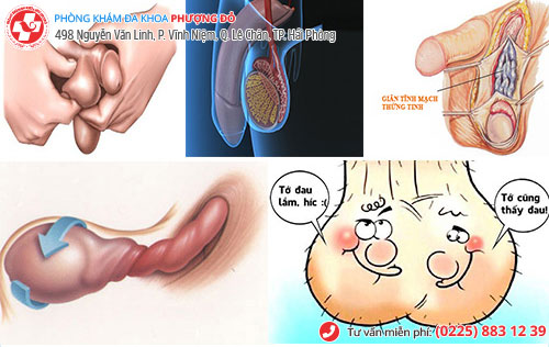 1 số dấu hiệu nam khoa nên đi khám sớm 1 số dấu hiệu nam khoa nên đi khám sớm