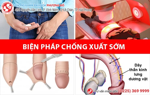 4 cách chống xuất tinh sớm an toàn, tránh biến chứng vô sinh nam