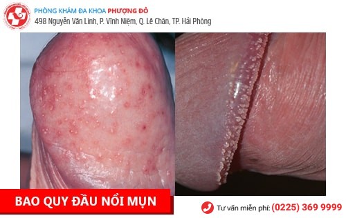 Địa chỉ phòng khám nam khoa Hạ Long uy tín Địa chỉ phòng khám nam khoa Hạ Long uy tín