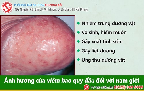 Hình ảnh viêm quy đầu chân thực nhất Hình ảnh viêm quy đầu chân thực nhất
