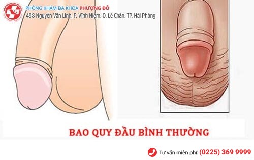 Hình ảnh bao quy đầu bình thường Hình ảnh bao quy đầu bình thường