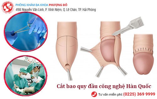Phòng Khám Phượng Đỏ cắt bao quy đầu công nghệ hiện đại Hàn Quốc Phòng Khám Phượng Đỏ cắt bao quy đầu công nghệ hiện đại Hàn Quốc