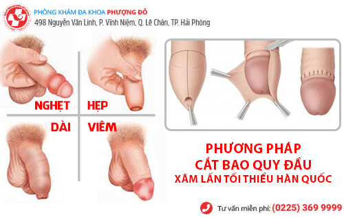 Cách lâu xuất tinh