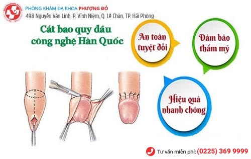 Phương pháp tiểu phẫu cắt bao quy đầu công nghệ xâm lấn tối thiểu Hàn Quốc Phương pháp tiểu phẫu cắt bao quy đầu công nghệ xâm lấn tối thiểu Hàn Quốc