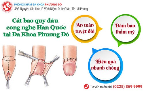 Tiểu phẫu cắt bao quy đầu giúp chữa viêm bao quy đầu hiệu quả Tiểu phẫu cắt bao quy đầu giúp chữa viêm bao quy đầu hiệu quả
