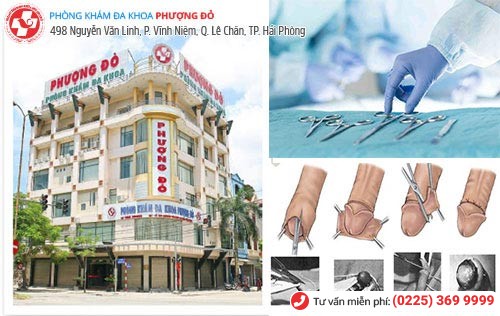 Phòng Khám Phượng Đỏ - địa chỉ cắt bao quy đầu Quảng Ninh hiệu quả Phòng Khám Phượng Đỏ - địa chỉ cắt bao quy đầu Quảng Ninh hiệu quả