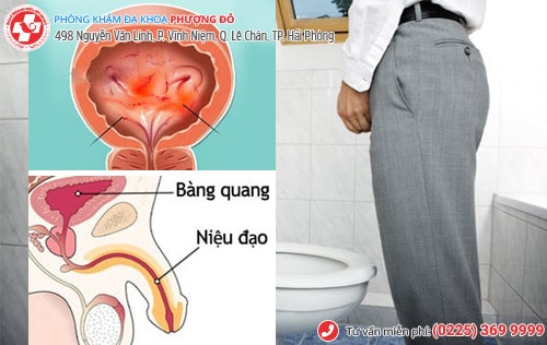 Đái buốt ở nam là bệnh gì? Chữa bằng phương pháp nào hiệu quả? Đái buốt ở nam là bệnh gì? Chữa bằng phương pháp nào hiệu quả?