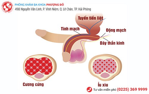 Nhận biết dấu hiệu liệt dương