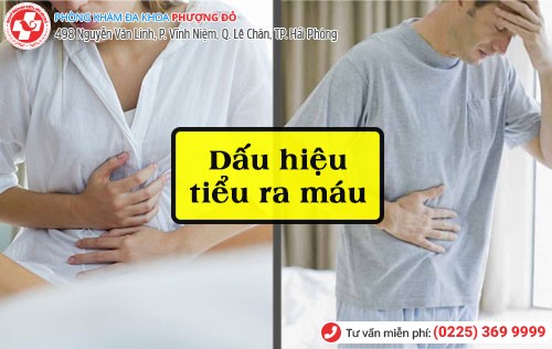 Biểu hiện của tiểu ra máu Dấu hiệu tiểu ra máu