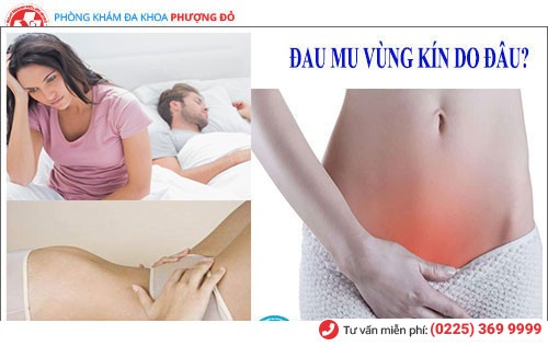 Sỏi bàng quang gây ra những cơn đau mu vùng kín Sỏi bàng quang gây ra những cơn đau mu vùng kín