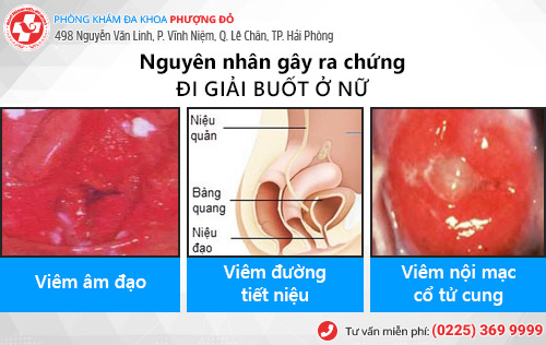 Đi giải buốt