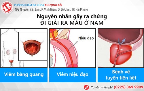 Đi giải đau, có máu là bệnh gì? Có nguy hiểm không? Đi giải đau, có máu là bệnh gì? Có nguy hiểm không?
