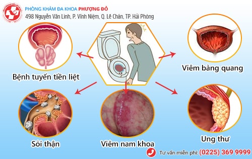 Đi giải ra máu 