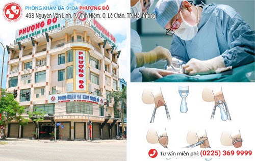 Xâm lấn tối thiểu công nghệ Hàn Quốc - kỹ thuật cắt bao quy đầu tiên tiến nhất hiện nay Xâm lấn tối thiểu công nghệ Hàn Quốc - kỹ thuật cắt bao quy đầu tiên tiến nhất hiện nay