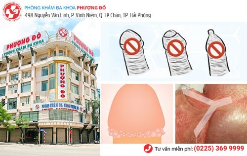 Dây hãm quy đầu bị ngắn có biểu hiện nào? Nguy hiểm không? Dây hãm quy đầu bị ngắn có biểu hiện nào? Nguy hiểm không?