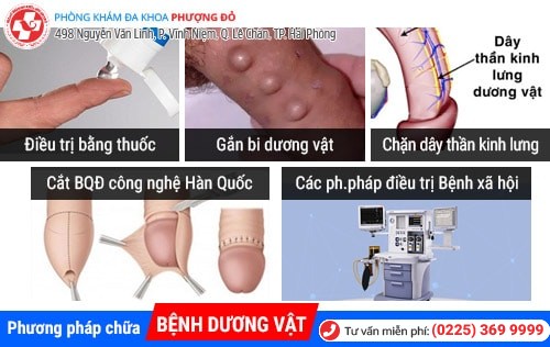 Bệnh dương vật là gì? Cách chữa trị hiệu quả hiện nay Bệnh dương vật là gì? Cách chữa trị hiệu quả hiện nay