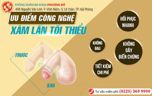 Ưu điểm công nghệ Hàn Quốc Ưu điểm công nghệ Hàn Quốc trị nghẹt bao quy đầu