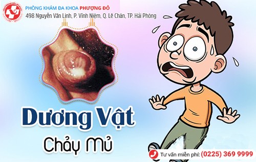 Xác định chính xác nguyên nhân dương vật chảy dịch mủ sẽ chữa trị kịp thời Xác định chính xác nguyên nhân dương vật chảy dịch mủ sẽ chữa trị kịp thời