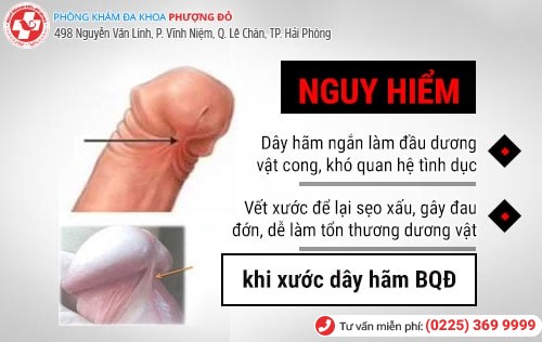 Xước dây hãm quy đầu là bị sao? Có chữa được không? Xước dây hãm quy đầu là bị sao? Có chữa được không?