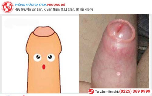 hinh-anh-hep-bao-quy-dau