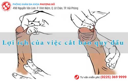 Tiểu phẫu bao quy đầu nhỏ nhưng mang lại nhiều lợi ích Tiểu phẫu bao quy đầu nhỏ nhưng mang lại nhiều lợi ích