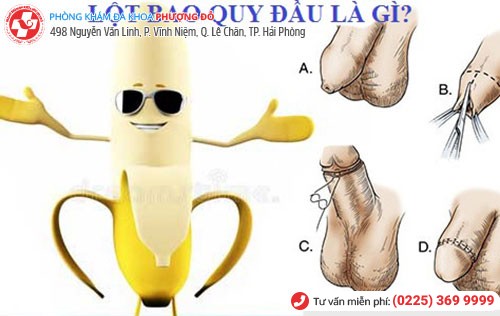 Lột bao quy đầu mang lại nhiều lợi ích cho nam giới Lột bao quy đầu mang lại nhiều lợi ích cho nam giới