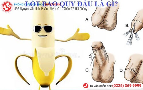 Hình ảnh bao quy đầu được lột Hình ảnh bao quy đầu được lột