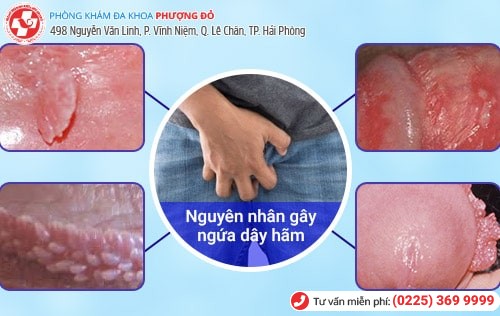 Ngứa dây hãm bao quy đầu là bệnh gì? Ngứa dây hãm bao quy đầu là bệnh gì?
