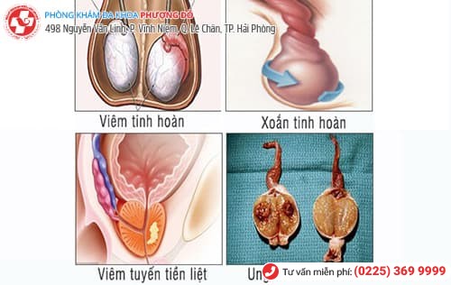 nguyên nhân gây đau tinh hoàn