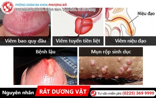 Nguyên nhân rát dương vật Nguyên nhân rát dương vật