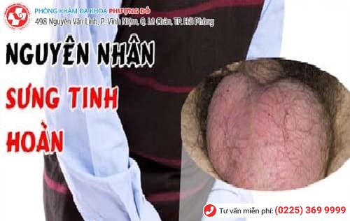 sưng tinh hoàn